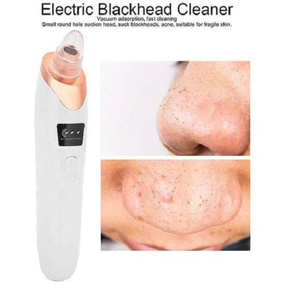 Blackhead Remover Machine Vacuum Acne Cleaner 5 In 1 Spots Removal Device